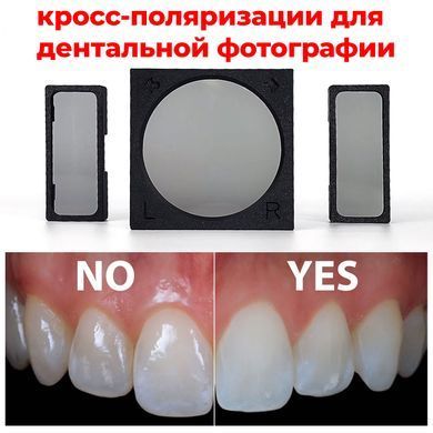Фотография - Набор кросс-поляризационных фильтров для дентальной фотографии